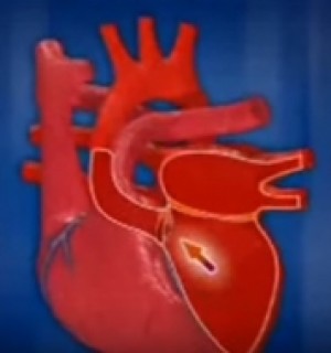 Ինչպես է աշխատում մարդու սիրտը