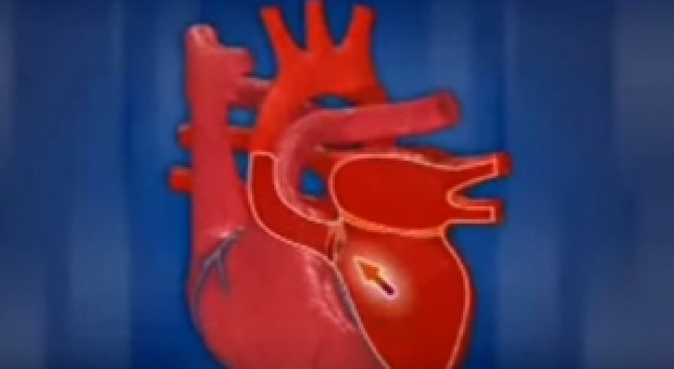 Ինչպես է աշխատում մարդու սիրտը