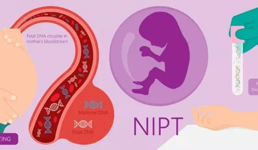 Ի՞նչ է NIPT-ը և ե՞րբ է անհրաժեշտ հանձնել