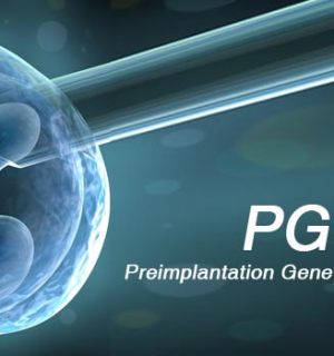 Preimplantation Genetic Testing (PGT)․ ե՞րբ և ու՞մ համար է անհրաժեշտ էմբրիոնների գենետիկական հետազոտությունը