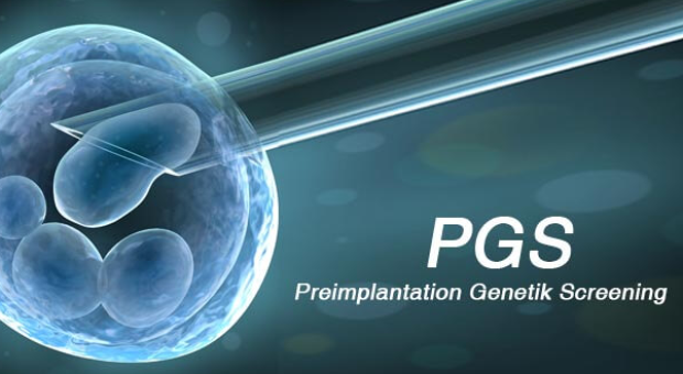 Preimplantation Genetic Testing (PGT)․ ե՞րբ և ու՞մ համար է անհրաժեշտ էմբրիոնների գենետիկական հետազոտությունը