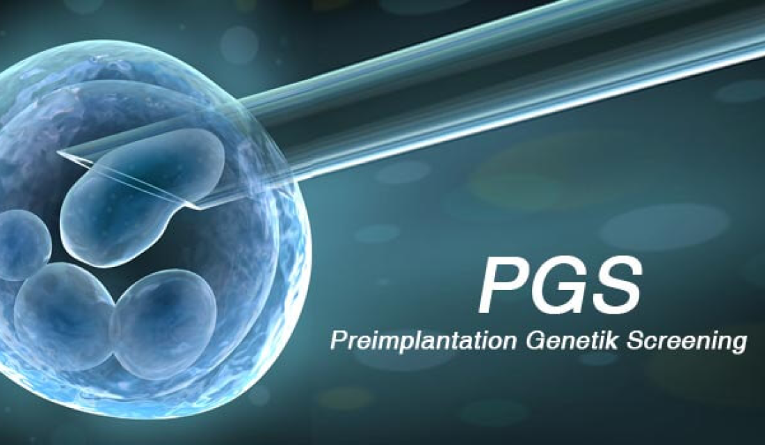 Preimplantation Genetic Testing (PGT)․ ե՞րբ և ու՞մ համար է անհրաժեշտ էմբրիոնների գենետիկական հետազոտությունը