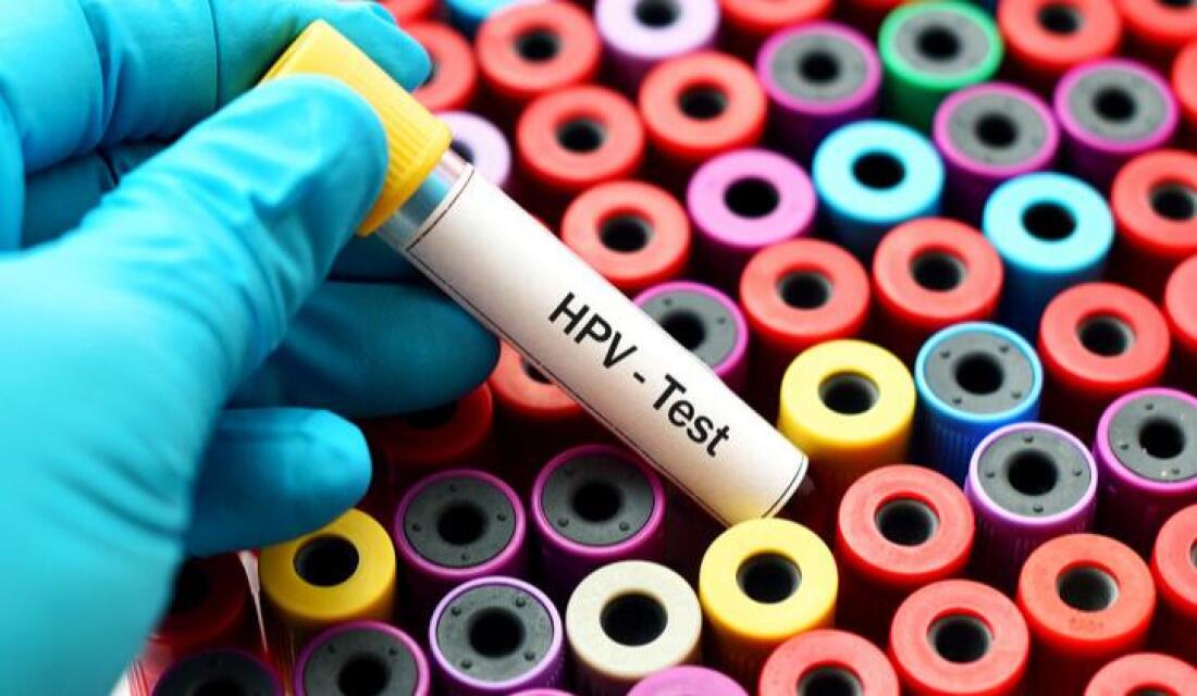 Մարդու պապիլոմավիրուս (HPV). ինչո՞ւ է կարևոր վաղ հայտնաբերումը