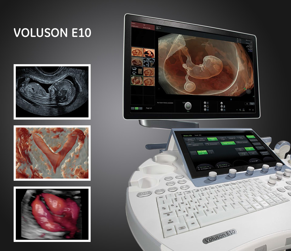 voluson-e10-header.jpg (194 KB)
